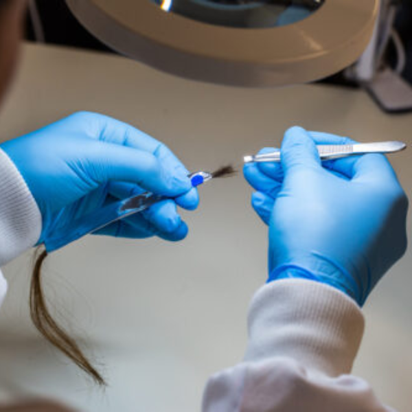 Lextox - Alcohol Testing Service